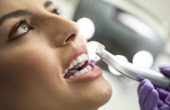 Closeup , teeth polishing procedure , closeup of beautiful young woman face